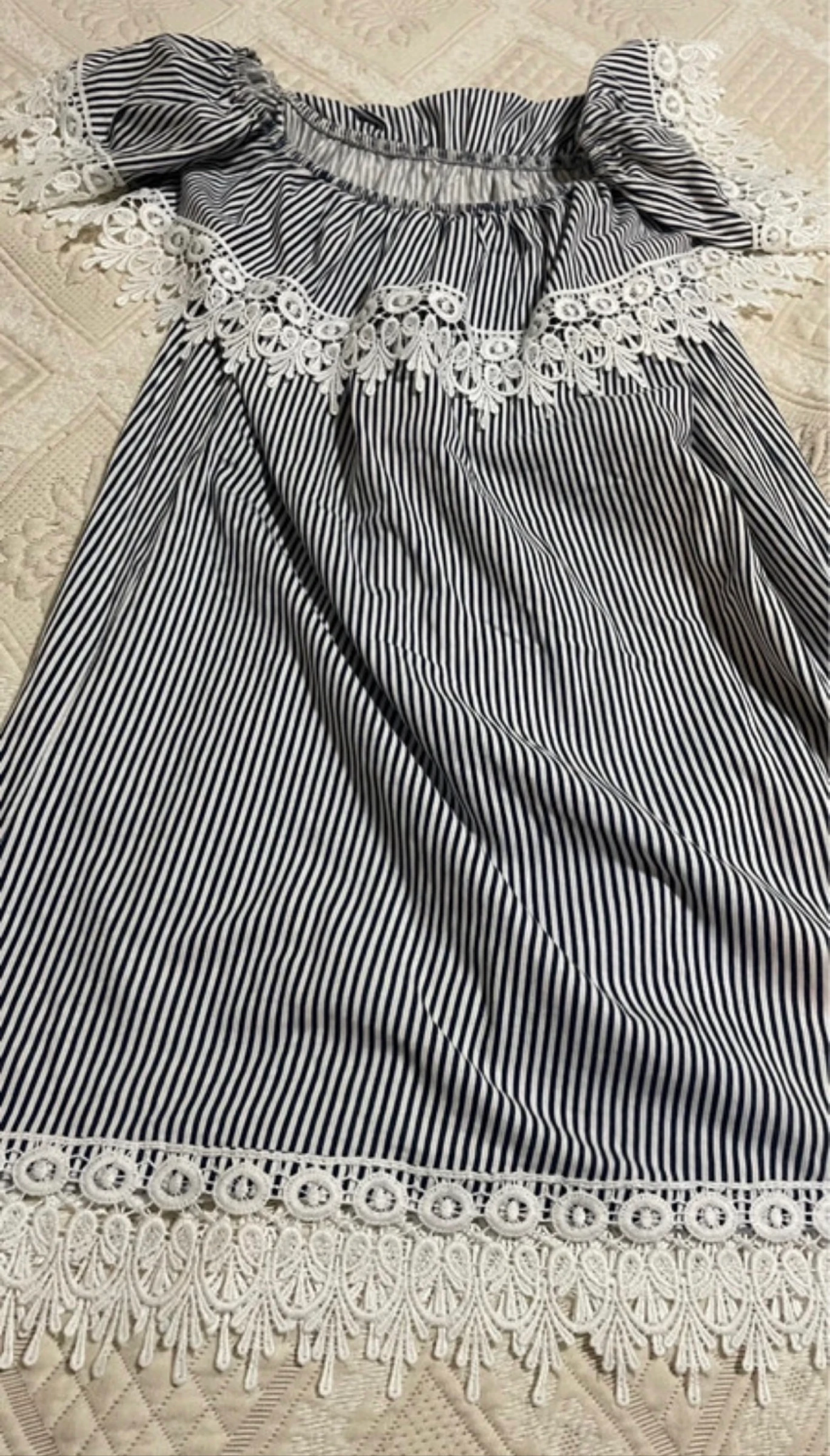 Short Striped Dress with Lace and Drop Shoulders. – photo 6